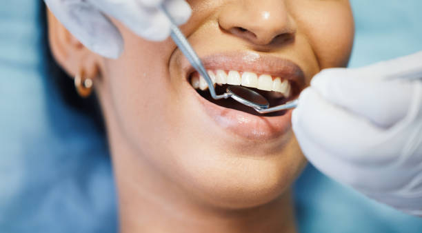 Best Emergency Root Canal Treatment in Glasgow, MO